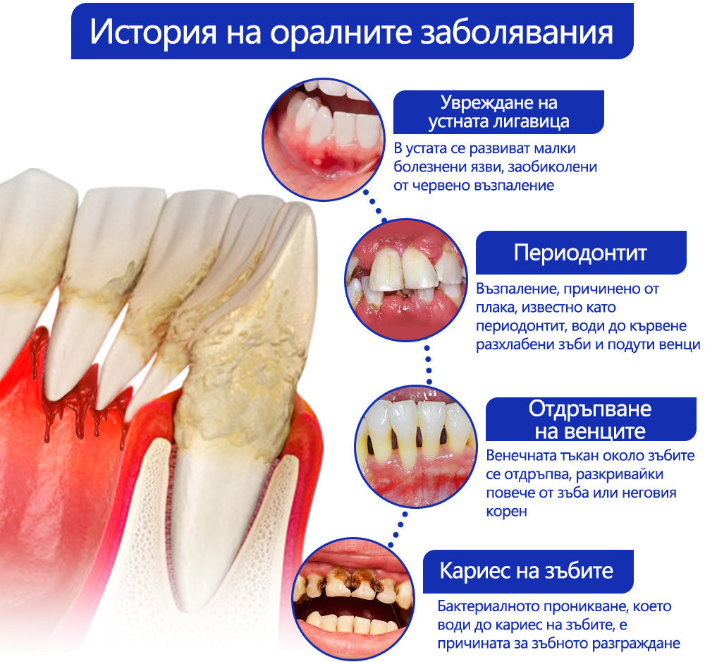 Furzero® ✅Focussmile Прах за третиране с пчелна отрова за перорално приложение 🦷🎁