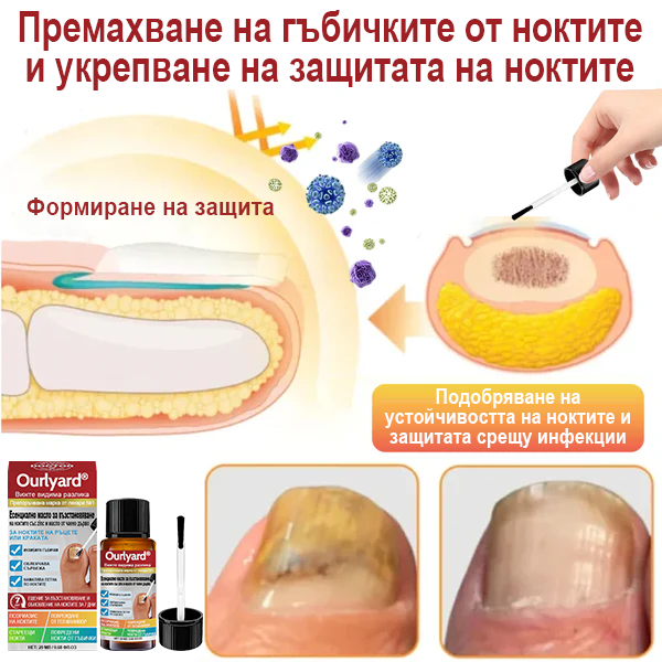 Ourlyard®🌲 Възстановяващо масло за нокти с цинк и чаено дърво (Напълно възстановено в рамките на една седмица, мощно лечение за всички проблеми с ноктите)💛