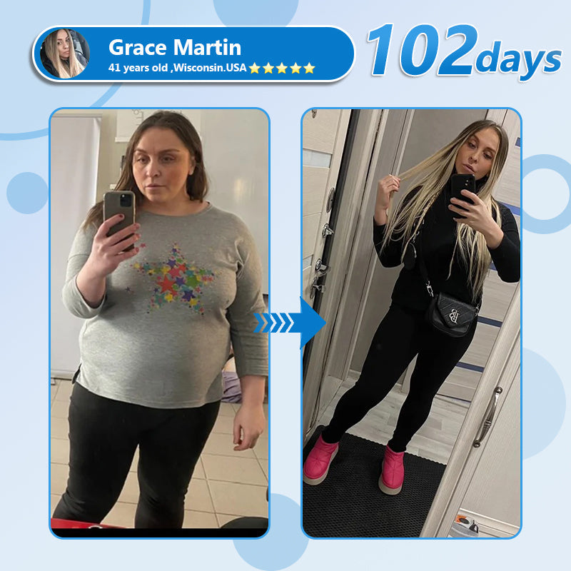 Croaie® Нано Микроиглен Пластир с SMGT-GLP-1 и Matrixyl 3000 За Стягане на Кожата, Намаляване на Тегло и Подкрепа на Кръвната Захар, Без Инжекции, Резултат за 7 Дни