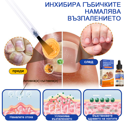 Furzero™ 💎Лечение на гъбички по ноктите с пчелна отрова: Пълно решение на проблема с гъбичките по ноктите 🐝