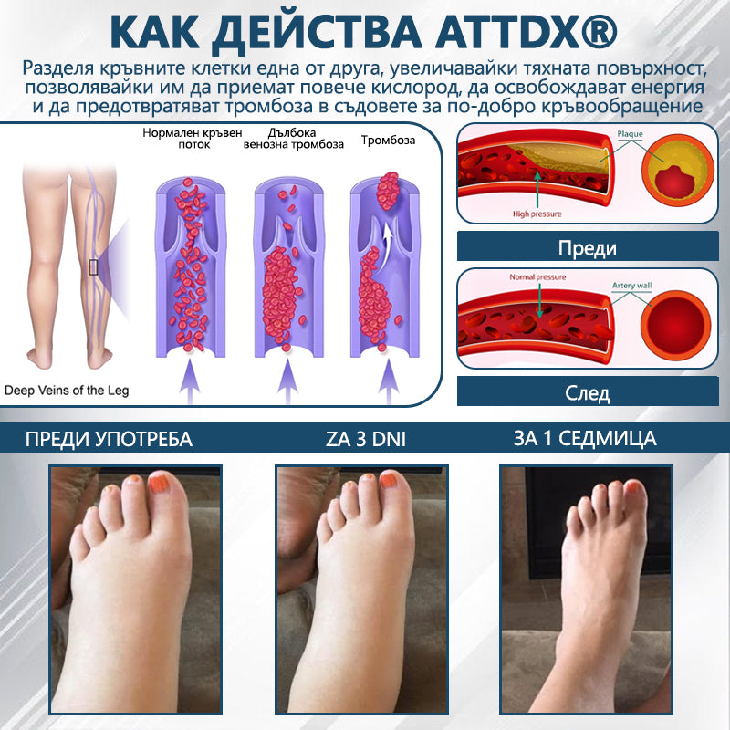 💧ATTDX® Билков успокояващ крем против отоци с черен кимион