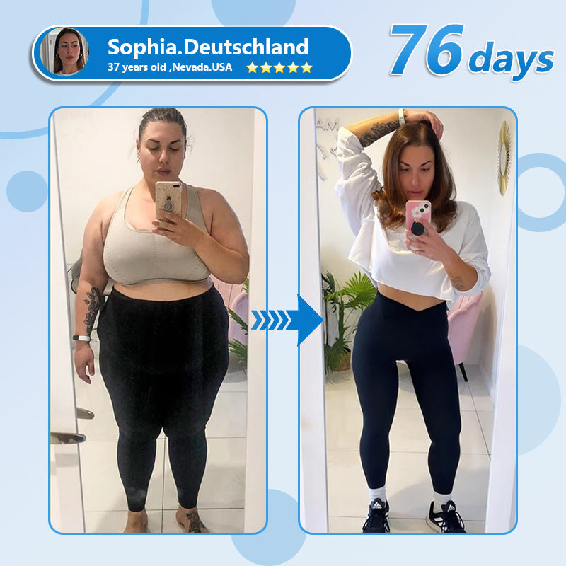 Croaie® Нано Микроиглен Пластир с SMGT-GLP-1 и Matrixyl 3000 За Стягане на Кожата, Намаляване на Тегло и Подкрепа на Кръвната Захар, Без Инжекции, Резултат за 7 Дни