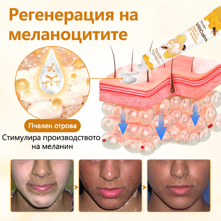 Timilk® Viticalm Крем за възстановяване на пигментация с пчелен отровен екстракт