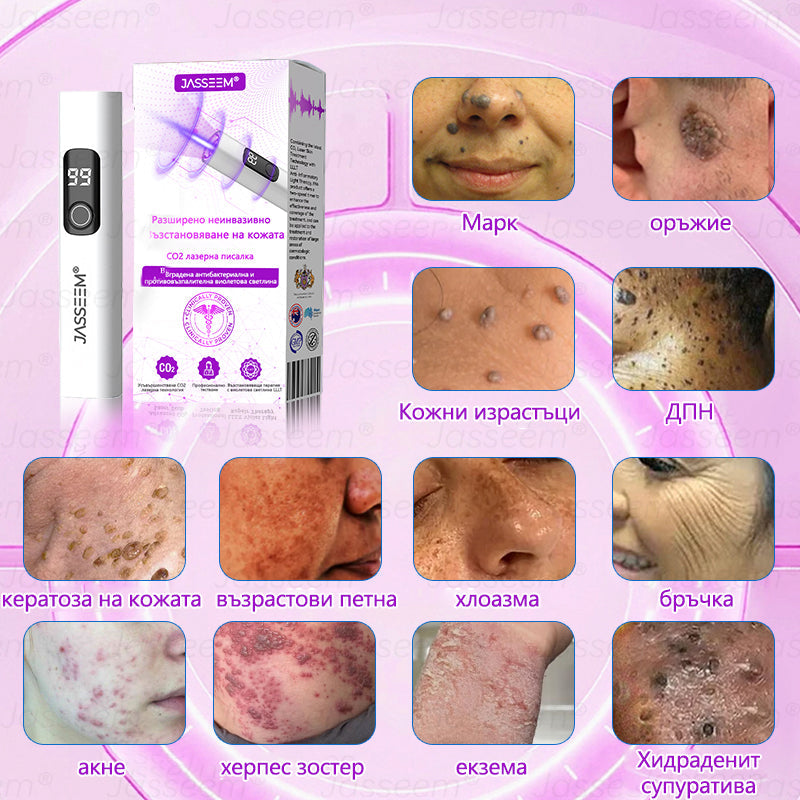 𝐉𝐚𝐬𝐬𝐞𝐞𝐦®✅ Усъвършенствана неинвазивна CO₂ лазерна писалка за грижа за кожата 💕(Нежно и ефективно премахва брадавици, бенки, старчески петна и кожни образувания – без болка и без усилие!)