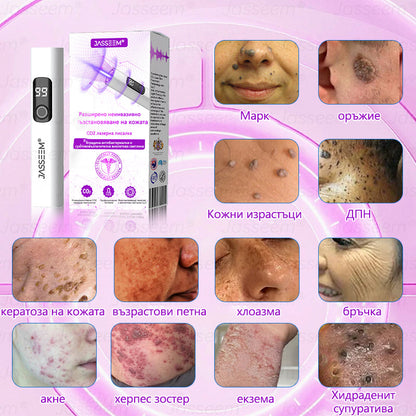 𝐉𝐚𝐬𝐬𝐞𝐞𝐦®✅ Усъвършенствана неинвазивна CO₂ лазерна писалка за грижа за кожата 💕(Нежно и ефективно премахва брадавици, бенки, старчески петна и кожни образувания – без болка и без усилие!)