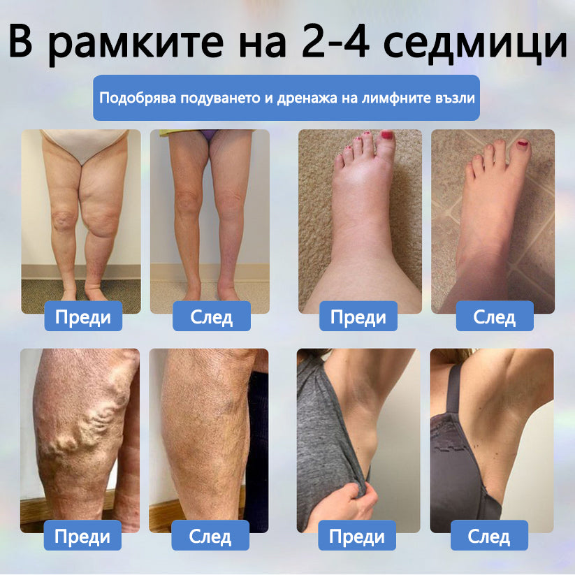 💧ATTDX® Билков успокояващ крем против отоци с черен кимион