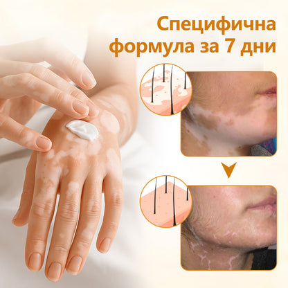 Timilk® Viticalm Крем за възстановяване на пигментация с пчелен отровен екстракт