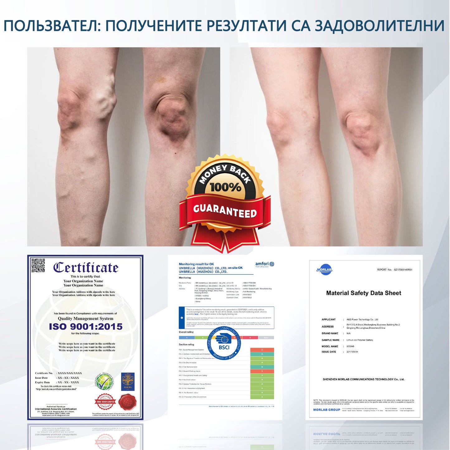 💧ATTDX® Билков успокояващ крем против отоци с черен кимион