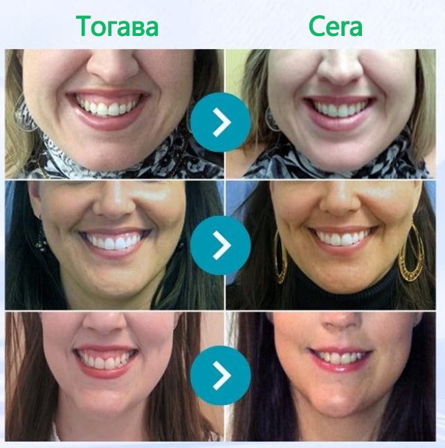 Furzero® ✅Focussmile Прах за третиране с пчелна отрова за перорално приложение 🦷🎁