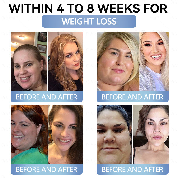 Croaie® Нано Микроиглен Пластир с SMGT-GLP-1 и Matrixyl 3000 За Стягане на Кожата, Намаляване на Тегло и Подкрепа на Кръвната Захар, Без Инжекции, Резултат за 7 Дни