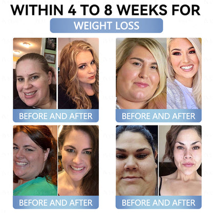 Croaie® Нано Микроиглен Пластир с SMGT-GLP-1 и Matrixyl 3000 За Стягане на Кожата, Намаляване на Тегло и Подкрепа на Кръвната Захар, Без Инжекции, Резултат за 7 Дни