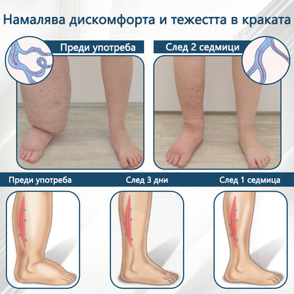 💧ATTDX® Билков успокояващ крем против отоци с черен кимион