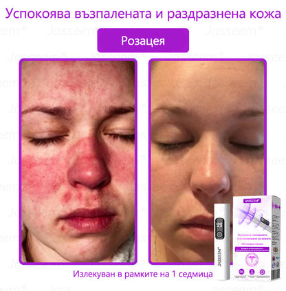 𝐉𝐚𝐬𝐬𝐞𝐞𝐦®✅ Усъвършенствана неинвазивна CO₂ лазерна писалка за грижа за кожата 💕(Нежно и ефективно премахва брадавици, бенки, старчески петна и кожни образувания – без болка и без усилие!)