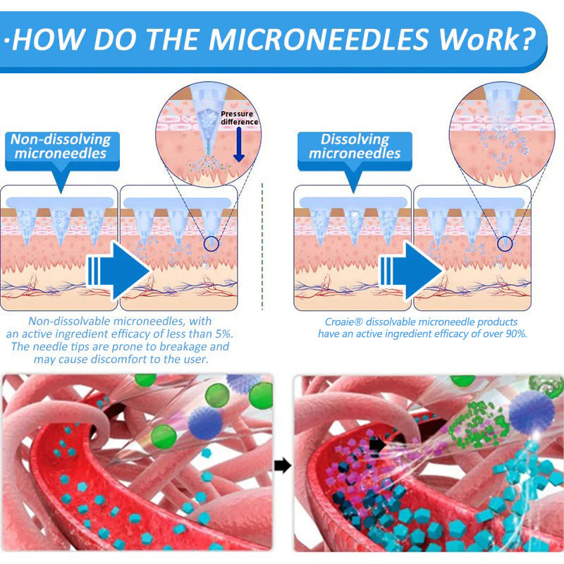 Croaie® Нано Микроиглен Пластир с SMGT-GLP-1 и Matrixyl 3000 За Стягане на Кожата, Намаляване на Тегло и Подкрепа на Кръвната Захар, Без Инжекции, Резултат за 7 Дни