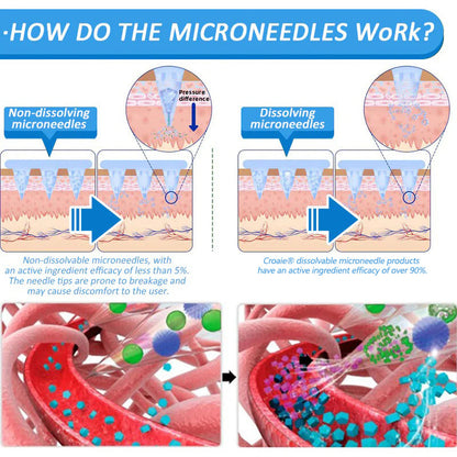 Croaie® Нано Микроиглен Пластир с SMGT-GLP-1 и Matrixyl 3000 За Стягане на Кожата, Намаляване на Тегло и Подкрепа на Кръвната Захар, Без Инжекции, Резултат за 7 Дни