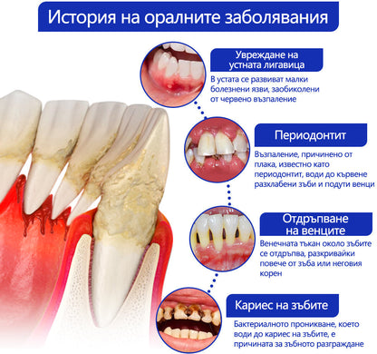 Furzero® ✅Focussmile Прах за третиране с пчелна отрова за перорално приложение 🦷🎁