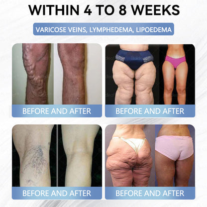 Croaie® Нано Микроиглен Пластир с SMGT-GLP-1 и Matrixyl 3000 За Стягане на Кожата, Намаляване на Тегло и Подкрепа на Кръвната Захар, Без Инжекции, Резултат за 7 Дни