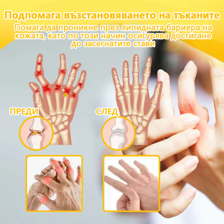 Ourlyard™ Магнезиево олио и спрей с пчелна отрова за възстановяване на ставите 👨‍⚕️ Одобрен от Българската агенция по лекарствата (БАЛ)